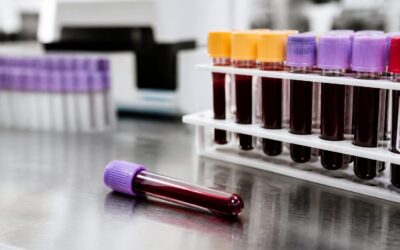Un nou test de sânge poate detecta mai fin urmele de cancer pancreatic la pacienții monitorizați