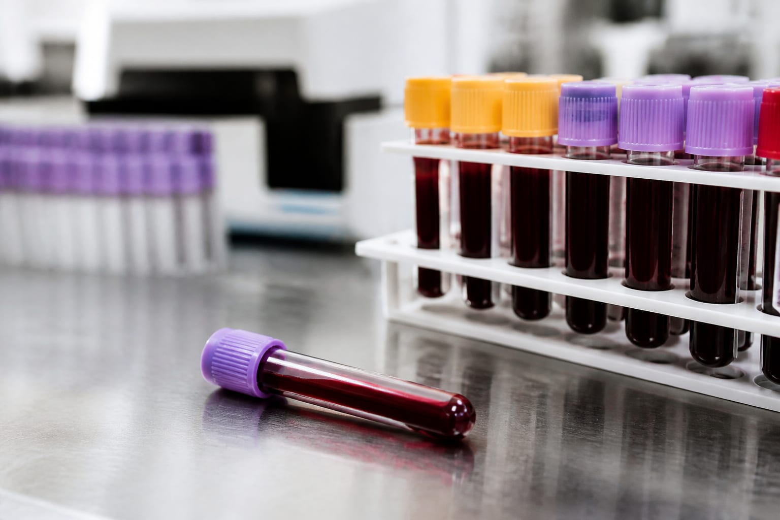 Un nou test de sânge poate detecta mai fin urmele de cancer pancreatic la pacienții monitorizați