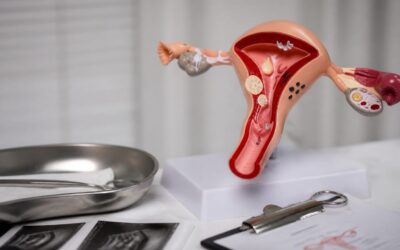Mâncărimea vaginală afectează 75% dintre femei cel puțin o dată și poate avea mai multe cauze