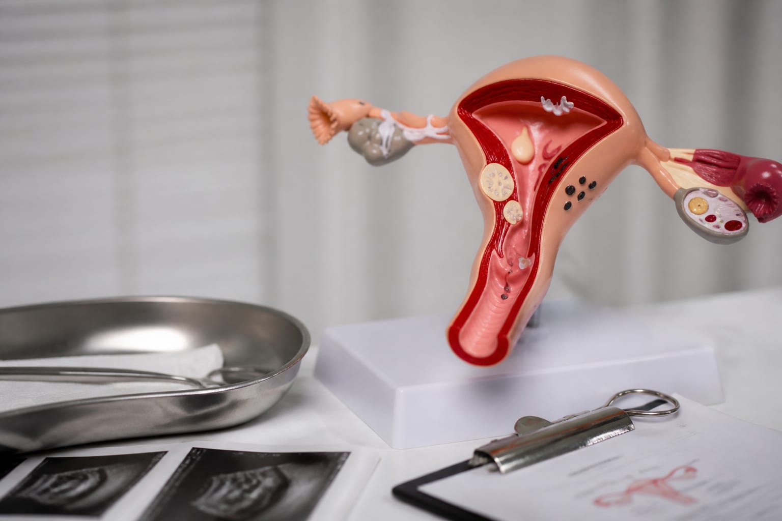 Mâncărimea vaginală afectează 75% dintre femei cel puțin o dată și poate avea mai multe cauze