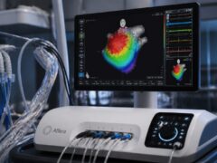 Spitalul Clinic de Recuperare Cluj-Napoca a introdus sistemul Affera pentru tratarea aritmiilor