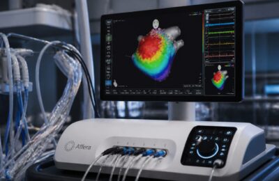 Spitalul Clinic de Recuperare Cluj-Napoca a introdus sistemul Affera pentru tratarea aritmiilor