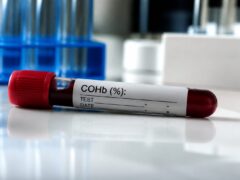 Un marker din sânge a prezis mai bine riscul de Alzheimer înainte de simptome