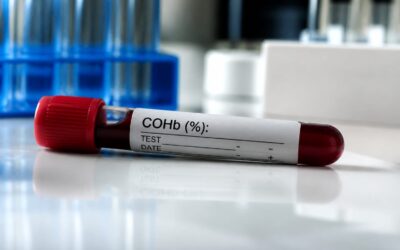 Un marker din sânge a prezis mai bine riscul de Alzheimer înainte de simptome