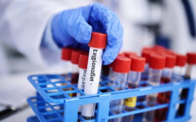 Legionella: 26 de cazuri într-un oraș european. Cum se transmite și ce măsuri de prevenție putem lua acasă