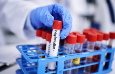 Legionella: 26 de cazuri într-un oraș european. Cum se transmite și ce măsuri de prevenție putem lua acasă