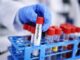 Legionella: 26 de cazuri într-un oraș european. Cum se transmite și ce măsuri de prevenție putem lua acasă