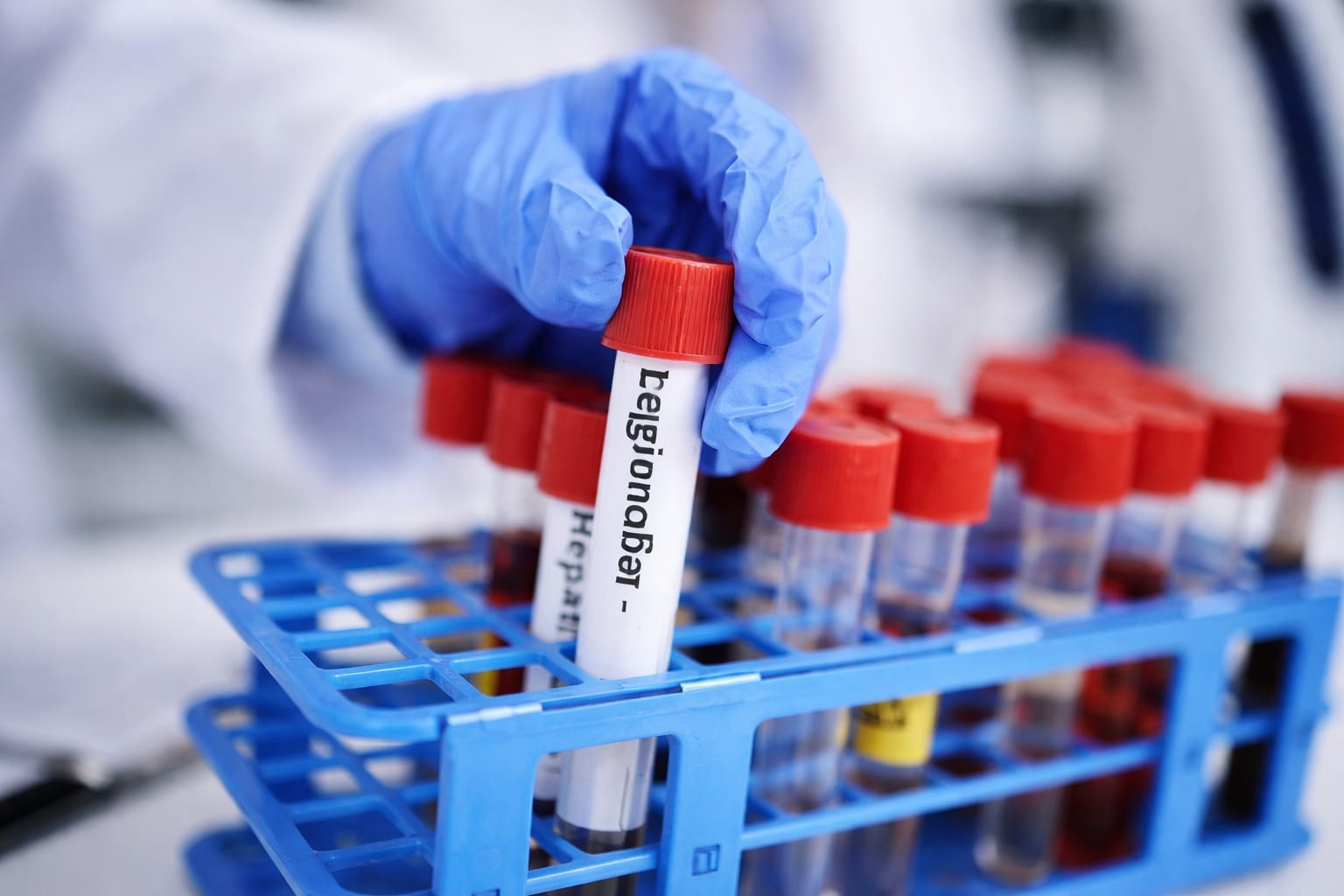 Legionella: 26 de cazuri într-un oraș european. Cum se transmite și ce măsuri de prevenție putem lua acasă