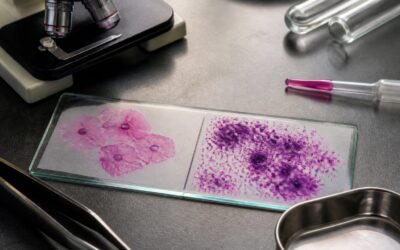 Un studiu confirmă că vaginoza bacteriană triplează riscul de infecții cu transmitere sexuală