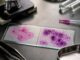 Un studiu confirmă că vaginoza bacteriană triplează riscul de infecții cu transmitere sexuală